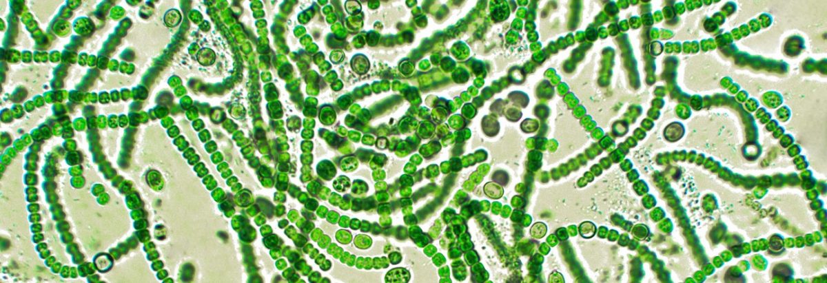 What Are Cyanobacteria  Oklahoma Department of 