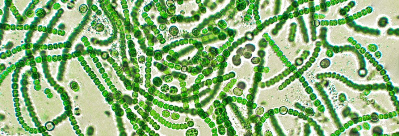 Группы организмов цианобактерии. Цианобактерии бациллы. Фотосинтезирующие цианобактерии. Цианобактерии кислород. Цианобактерии нити.